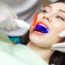 Which Whitening Treatment Is Best